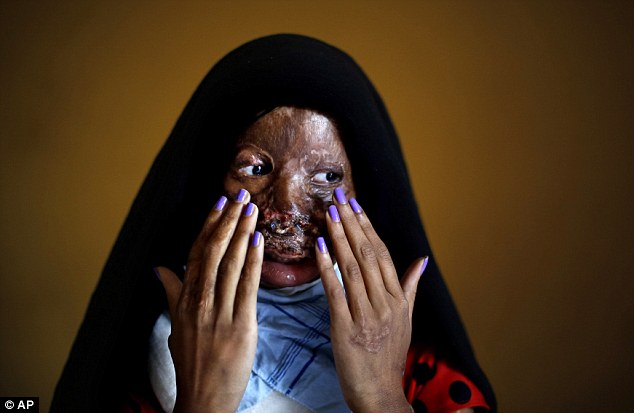 17674926929450079489