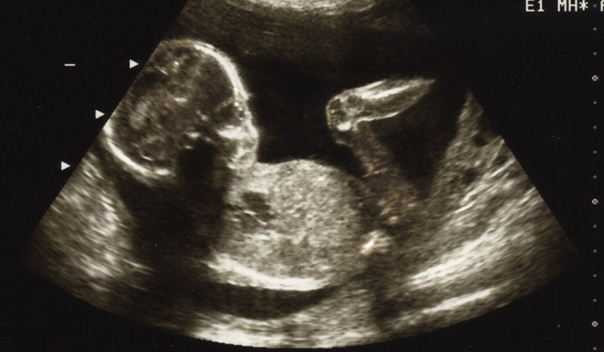Abortion roe v wade unborn children women feminism march life 1