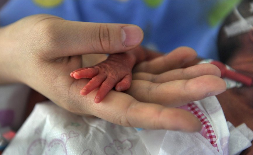 prematurebaby11.png Prematurebaby11